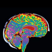       -  (fMRI)       15  ( Science). 