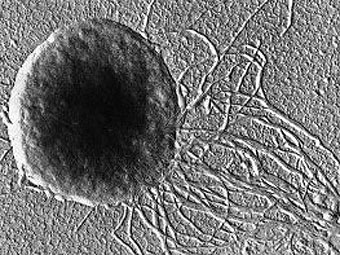  Methanococcus jannaschii.        .    bioinfo.bact.wisc.edu